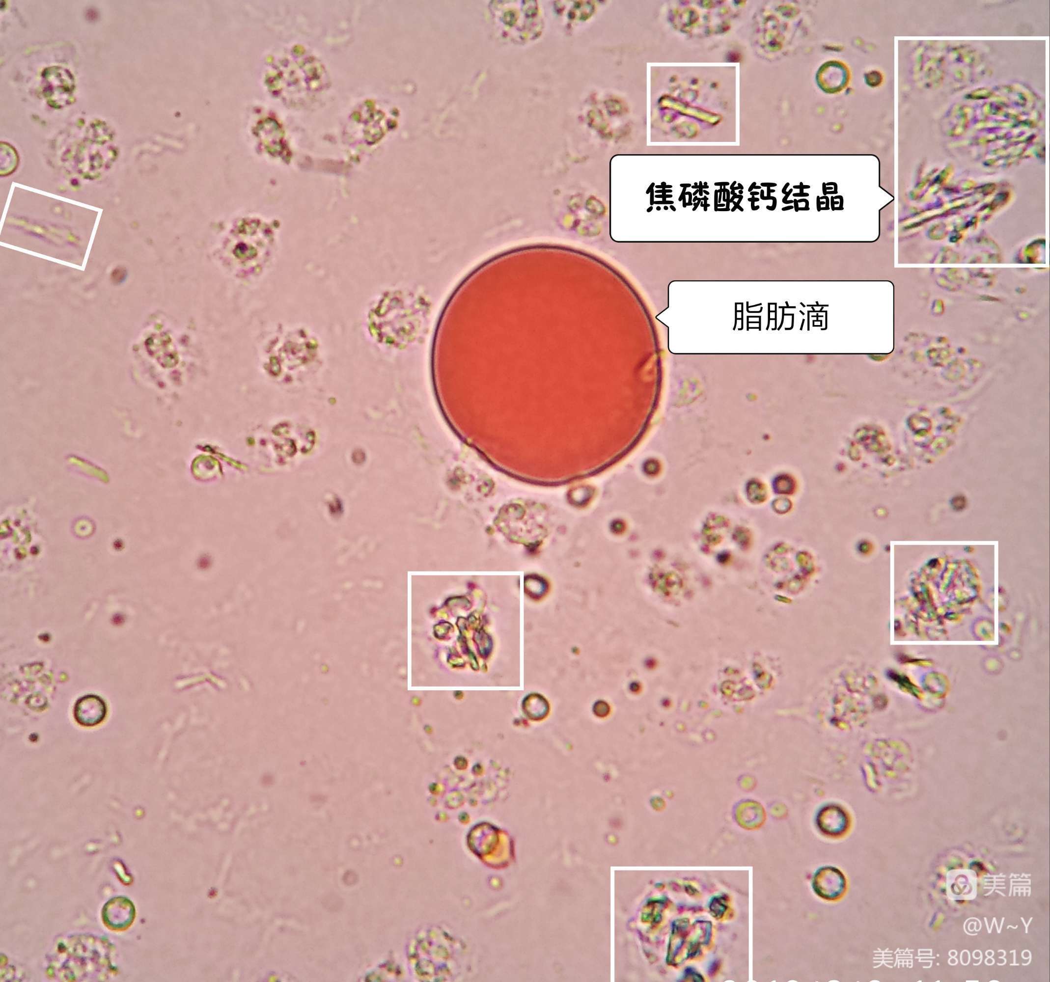 磷酸钙结晶_磷酸三钙(tcp)_磷酸三钙含量