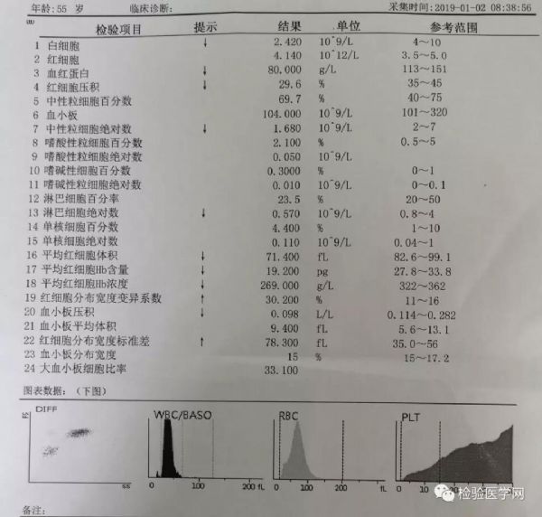 血小板平均宽度偏低_血小板平均宽度偏高_平均血小板分布宽度偏低